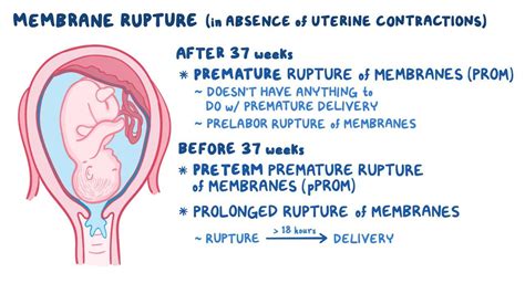 Leaking amniotic fluid (premature rupture of membranes)